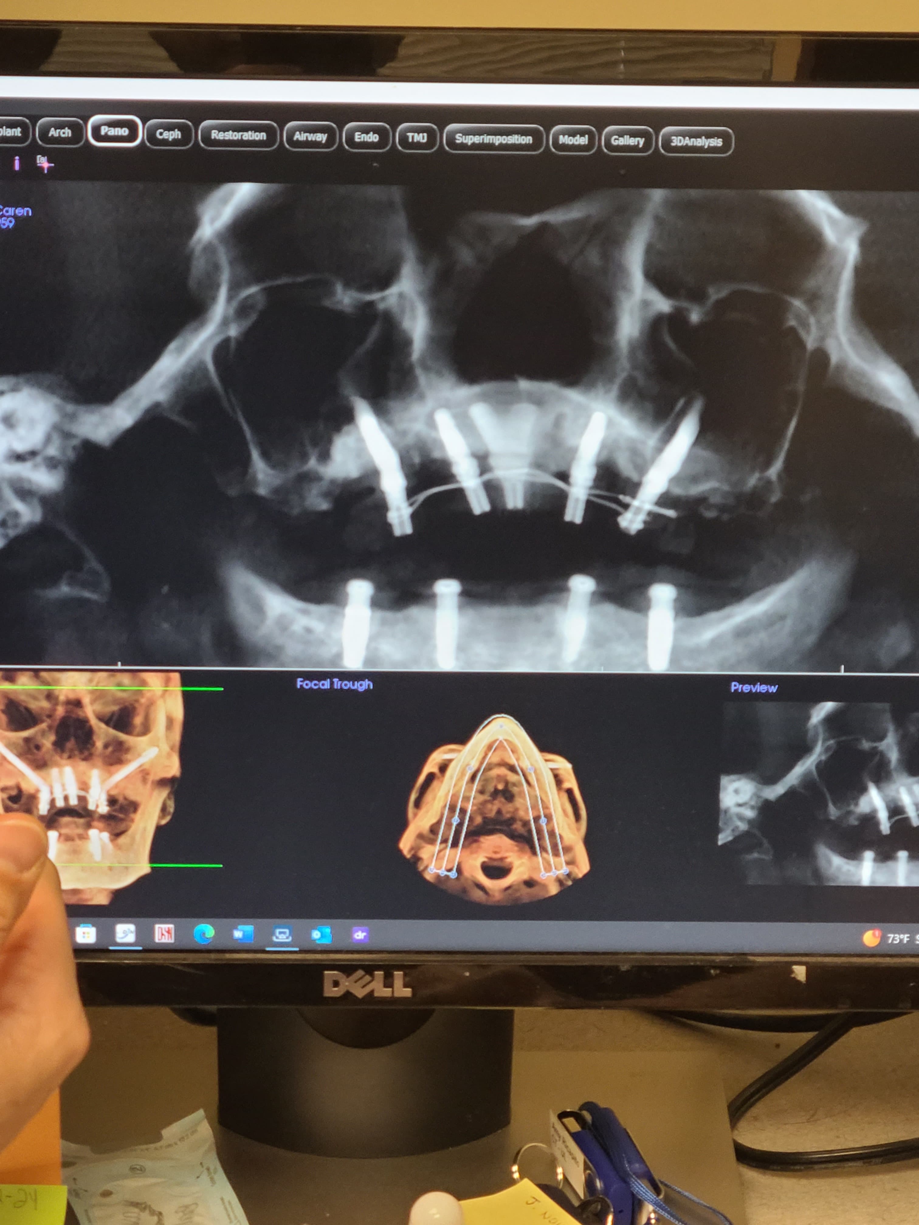 Digital dentistry workflow